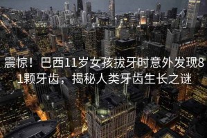 震驚！巴西11歲女孩拔牙時意外發(fā)現(xiàn)81顆牙齒，揭秘人類牙齒生長之謎