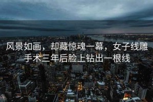 風(fēng)景如畫，卻藏驚魂一幕，女子線雕手術(shù)三年后臉上鉆出一根線